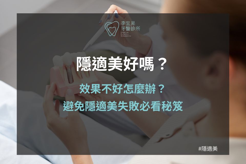 隱適美好嗎？效果不好怎麼辦？避免隱適美失敗必看秘笈