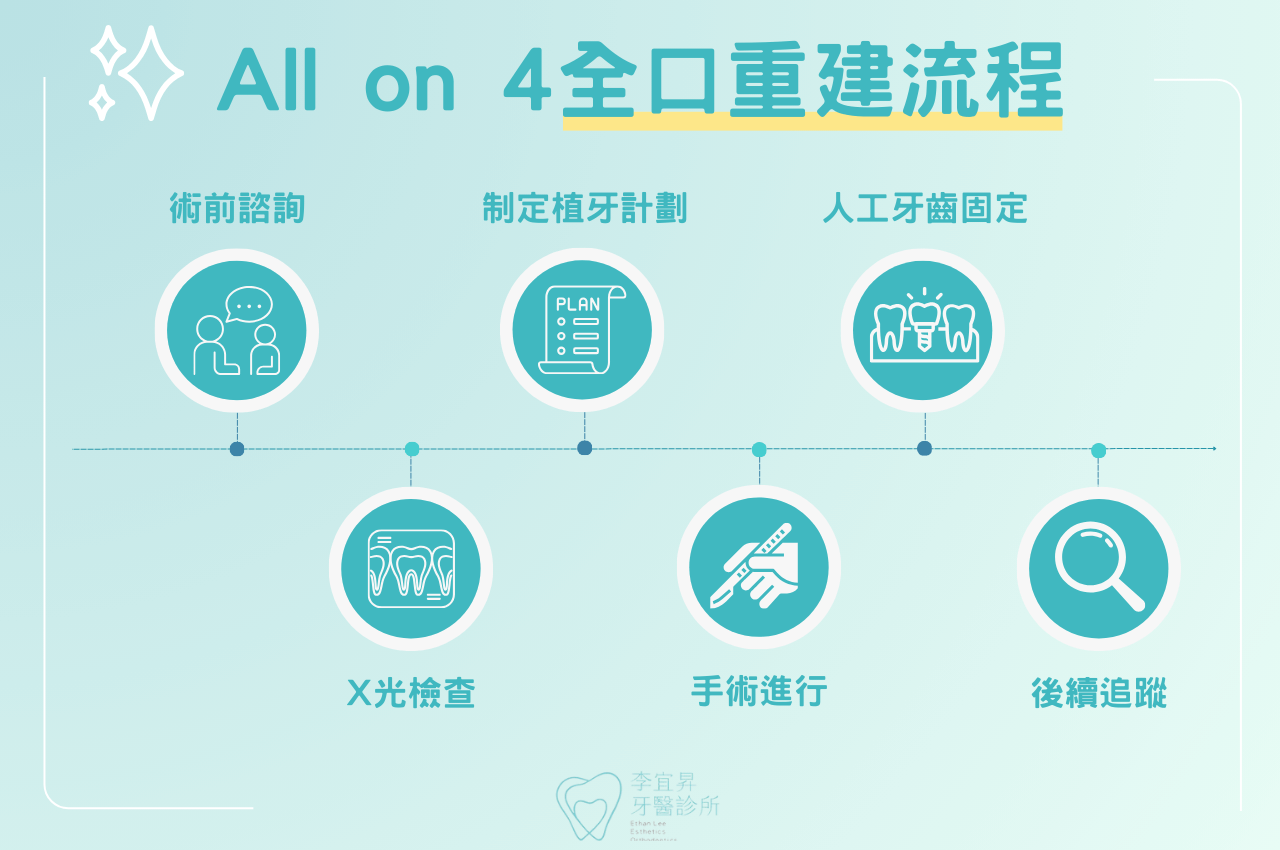 All on 4全口重建流程