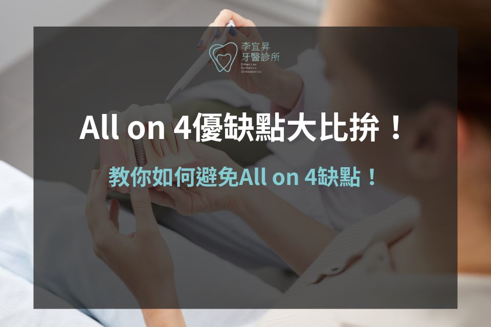 All on 4優缺點大比拚！專業醫師教你如何避免All on 4缺點！