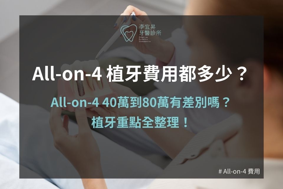 All-on-4 植牙費用都多少？All-on-4 40萬到80萬有差別嗎？植牙重點全整理！