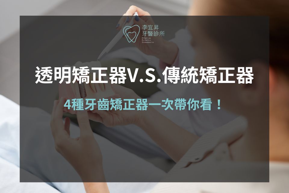 透明矯正器V.S.傳統矯正器哪個好？4種牙齒矯正器一次帶你看！