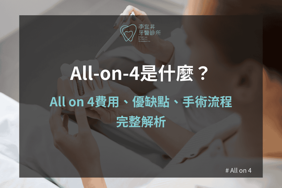 Read more about the article All-on-4 到底好在哪？完整解析All on 4費用、優缺點、手術流程