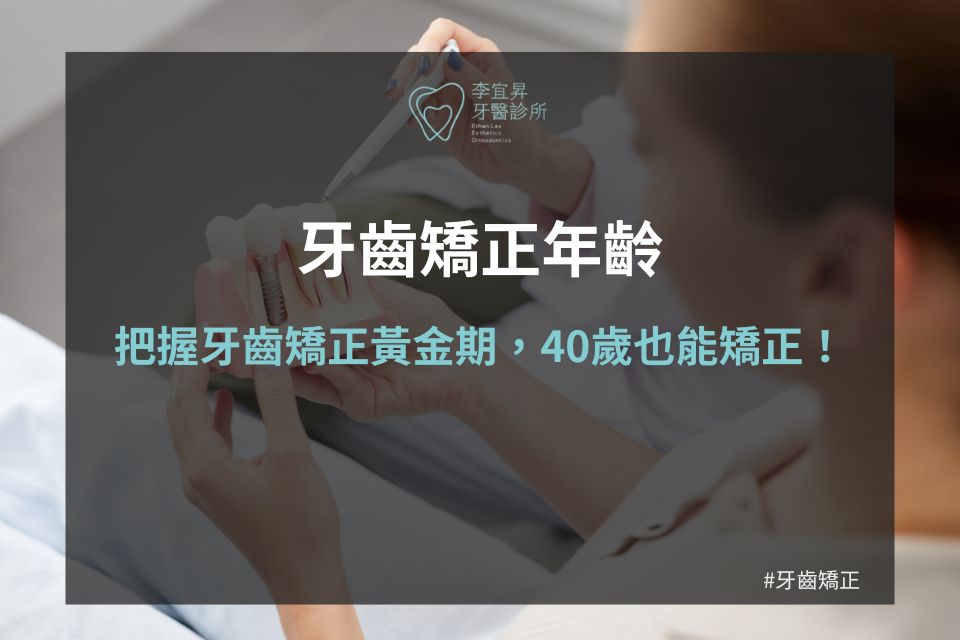 Read more about the article 牙齒矯正年齡沒限制嗎？沒想到40歲矯正牙齒還來的及